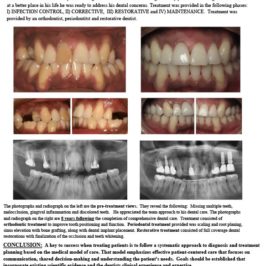 Comprehensive Dental Treatment